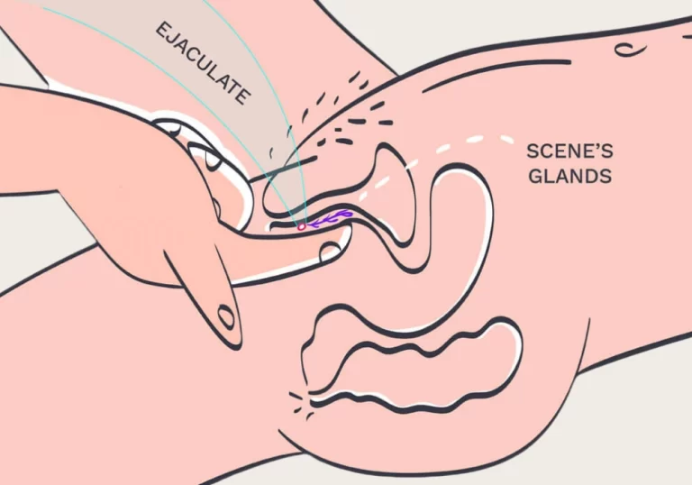 woman-sensitive-spot